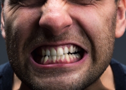sleep bruxism